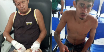 Dois homens são encaminhados ao hospital após briga com facas no interior do Piauí