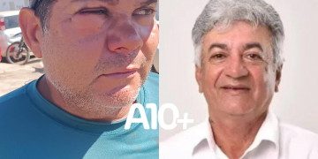 Ex-vereador passa a usar tornozeleira eletrônica após agredir a socos servidor público no interior do Piauí