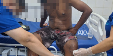 Criminosos invadem casa e tentam matar homem a tiros no interior do Piauí; polícia investiga motivação