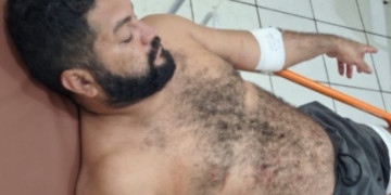 Homem é baleado após suspeita de perseguir mulher no Piauí; ainda teria importunado profissional durante atendimento