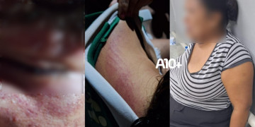 Criança é encontrada em via pública com marcas de agressão em todo o corpo no Piauí; mãe é conduzida como principal suspeita