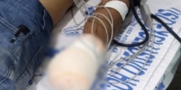 Homem tem mão decepada ao se envolver em briga por causa de terreno no Piauí; suspeito é o vizinho que está foragido
