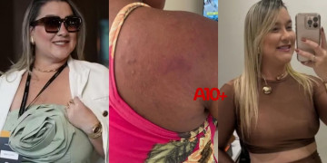 Polícia prende em Teresina ex-patroa acusada de agredir funcionária grávida no Maranhão