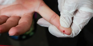 Fundação Municipal de Saúde disponibiliza testes rápidos da dengue em 3 UPAs e 2 hospitais de Teresina