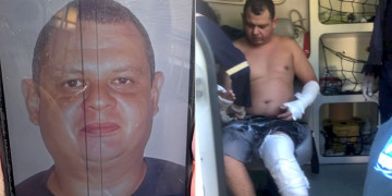Homem é preso suspeito de tentar matar ex-companheira e ex-sogra incendiadas em Teresina