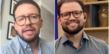 Felipe Pereira relata complicação em olho após aplicação de Botox e faz alerta sobre procedimentos estéticos