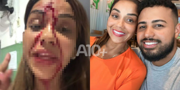 Walkiria Estarley denuncia relacionamento abusivo com ex-companheiro e agressão em Teresina; artista aparece com corte na testa