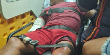 Dono de bar fica ferido após ser baleado em tentativa de homicídio no litoral do Piauí