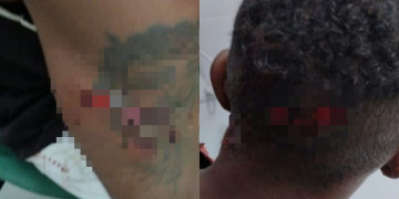 Jovem sofre tentativa de homicídio a facadas no Piauí; principal suspeito é padrasto da namorada da vítima