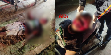 Homem sofre tentativa de homicídio e fica com rosto desfigurado no Piauí; já tinha registrado BO sobre ameaças