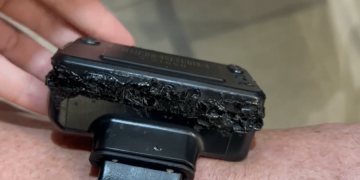 Bolsonaro mostra tornozeleira queimada e admite uso de ferro de solda