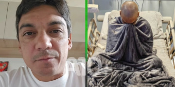 Bruno Neto, prefeito de Angical, comemora sucesso do transplante de medula óssea