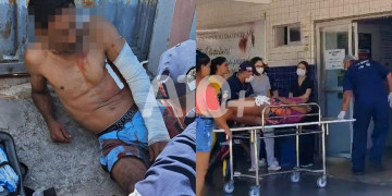 Homem e mulher sofrem tentativa de homicídio ao serem baleados no litoral do Piauí