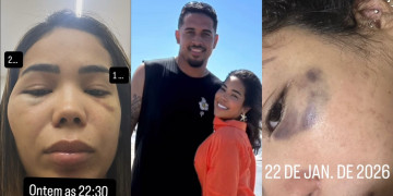 Influencer relata agressões do companheiro em Teresina: “sempre teve muita confusão”; VÍDEO!