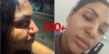 Após expor o ex-companheiro em rede social, influencer denuncia agressões em Teresina: “armou pra mim”