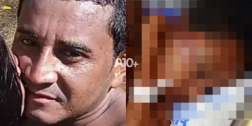 Mulher é brutalmente agredida por ex que não aceitava o fim do relacionamento em Timon; família pede justiça