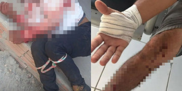 Irmãos reagem a assalto, são baleados e imobilizam criminoso no Piauí; lista com nomes de estabelecimentos é apreendida