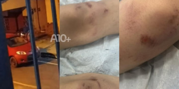 Adolescente é espancado por dois homens e fica internado em hospital no Piauí