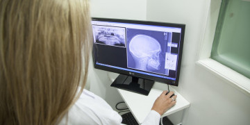 Reunião discute terceirização de laudos de exames radiológicos e de ultrassonografia por telerradiologia em Teresina