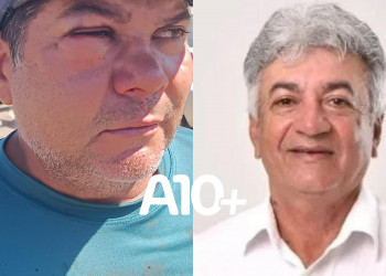 Ex-vereador passa a usar tornozeleira eletrônica após agredir a socos servidor público no interior do Piauí