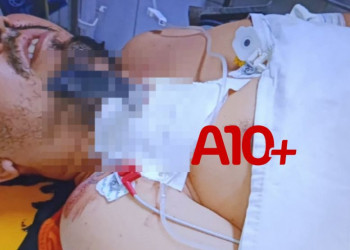Disputa por passageiro motivou briga que terminou com motorista de app esfaqueado no Aeroporto de Teresina, diz polícia