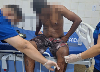 Criminosos invadem casa e tentam matar homem a tiros no interior do Piauí; polícia investiga motivação