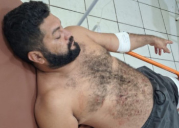 Homem é baleado após suspeita de perseguir mulher no Piauí; ainda teria importunado profissional durante atendimento