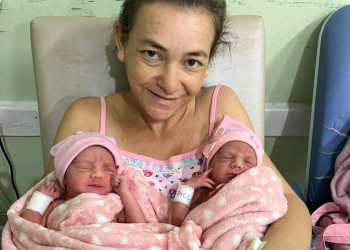 Mulher de 42 anos dá à luz gêmeas em gestação extremamente rara no Piauí