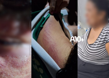 Criança é encontrada em via pública com marcas de agressão em todo o corpo no Piauí; mãe é conduzida como principal suspeita