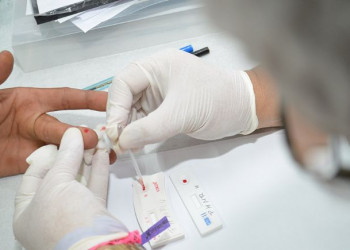 Número de pessoas com HIV em tratamento no Brasil cresce 84% durante os últimos 11 anos