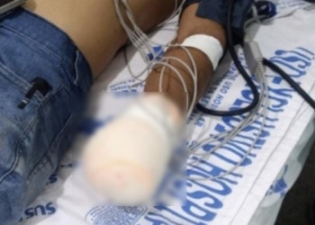 Homem tem mão decepada ao se envolver em briga por causa de terreno no Piauí; suspeito é o vizinho que está foragido