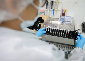 Malária: Anvisa autoriza teste em humanos de vacina 100% brasileira