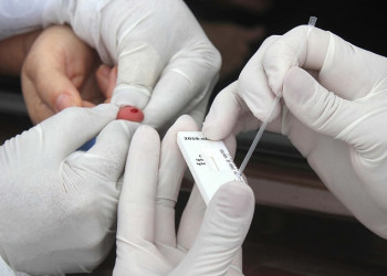 Piauí registra mais de 600 casos e sete mortes por covid em 24 horas