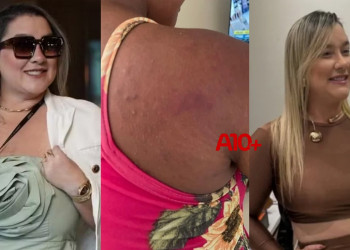 Polícia prende em Teresina ex-patroa acusada de agredir funcionária grávida no Maranhão