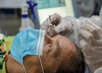 Governo do Piauí realizará mais de 5 mil cirurgias de catarata neste semestre