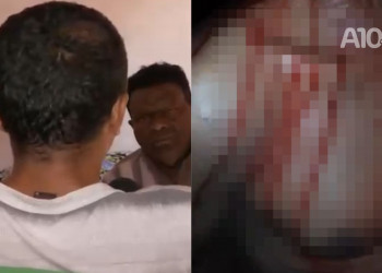 “Achavam que eu tinha condição”, diz homem que foi sequestrado e torturado por bandidos em Teresina