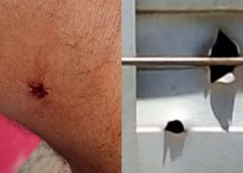 Cadeirante é preso por suspeita de tentar matar o próprio pai com tiro de espingarda no Piauí