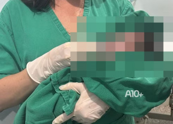 Bebê é levada para o hospital após ser abandonada em sacola de lixo na zona Sul de Teresina