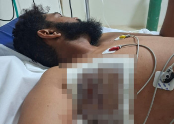 Homem sofre tentativa de homicídio em posto de combustíveis no interior do Piauí