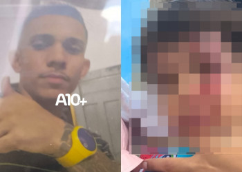 Criança é atingida no rosto por tijolo durante briga envolvendo o próprio pai na zona Norte de Teresina