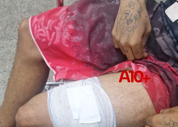 Homem é internado com ferimento na perna, alega ter sido esfaqueado por companheira, mas hospital aponta para disparo de arma de fogo no Piauí