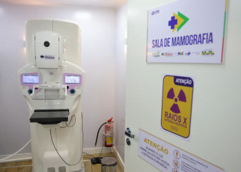 Lei garante mamografia pelo SUS para mulheres a partir dos 40 anos