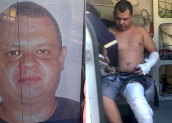 Homem é preso suspeito de tentar matar ex-companheira e ex-sogra incendiadas em Teresina