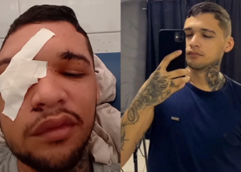 Homem é baleado na cabeça após ser confundido com irmão em Teresina; suspeita é que familiar seja envolvido com facção