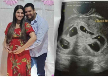 Mulher descobre gravidez de sêxtuplos dois dias antes do Dia das Mães