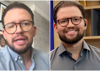 Felipe Pereira relata complicação em olho após aplicação de Botox e faz alerta sobre procedimentos estéticos