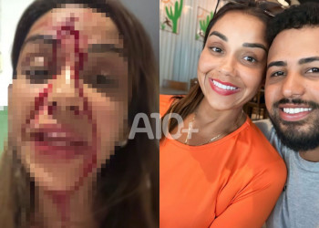Walkiria Estarley denuncia relacionamento abusivo com ex-companheiro e agressão em Teresina; artista aparece com corte na testa