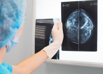 Lineu Araújo, em Teresina, ofertará mamografias todas as sextas-feiras de outubro