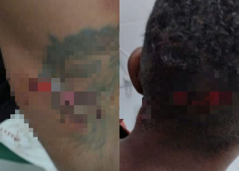 Jovem sofre tentativa de homicídio a facadas no Piauí; principal suspeito é padrasto da namorada da vítima