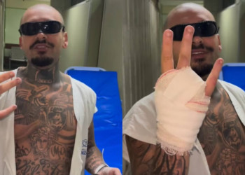 Influenciador perde dedo ao tentar invadir o Rock in Rio e promete leiloar parte amputada